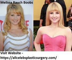 andrew adorno recommends Melissa Rauch Breast