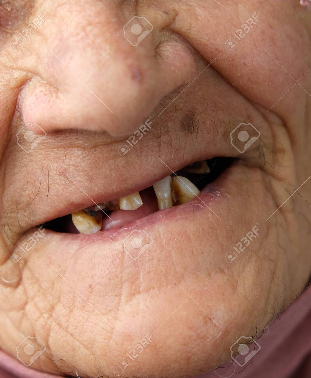 cecille glorioso recommends No Teeth Old Lady
