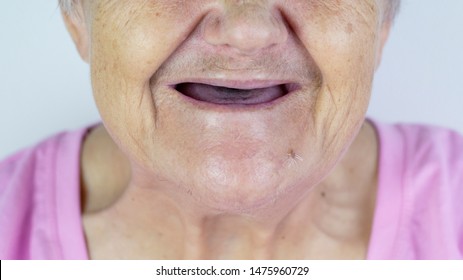 chris mok recommends no teeth old lady pic